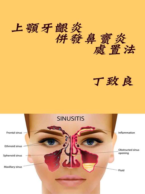 Cover image for 上顎牙齦炎併發鼻竇炎及竇口通處置法